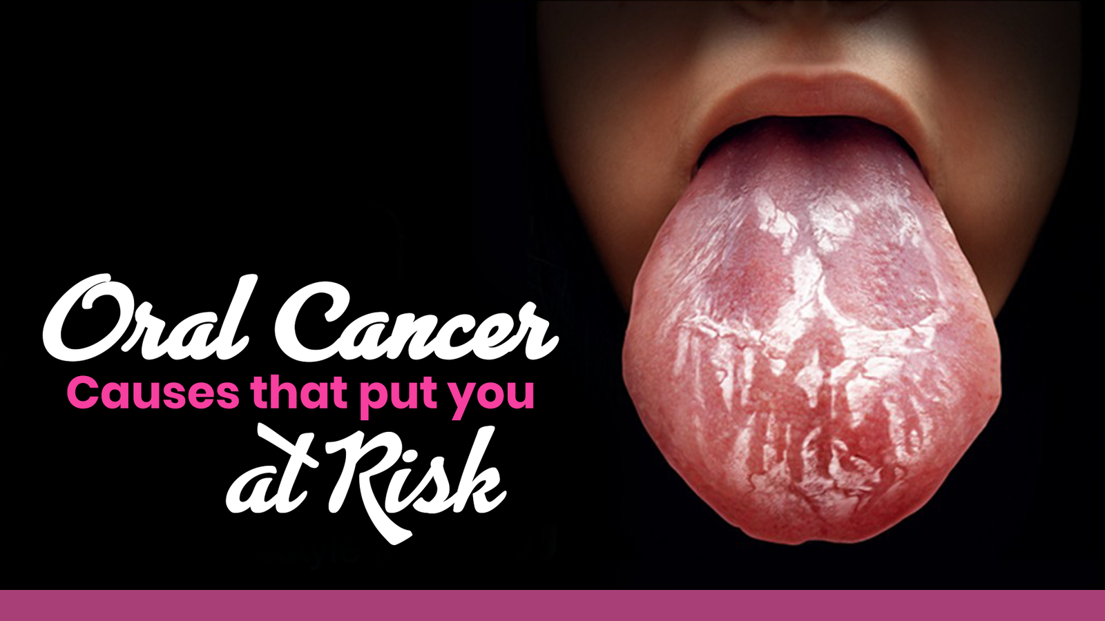 oral-cancer-causes-that-put-you-at-risk