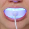 led-teeth-1080x675