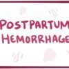 What is Postpartum Haemorrhage?