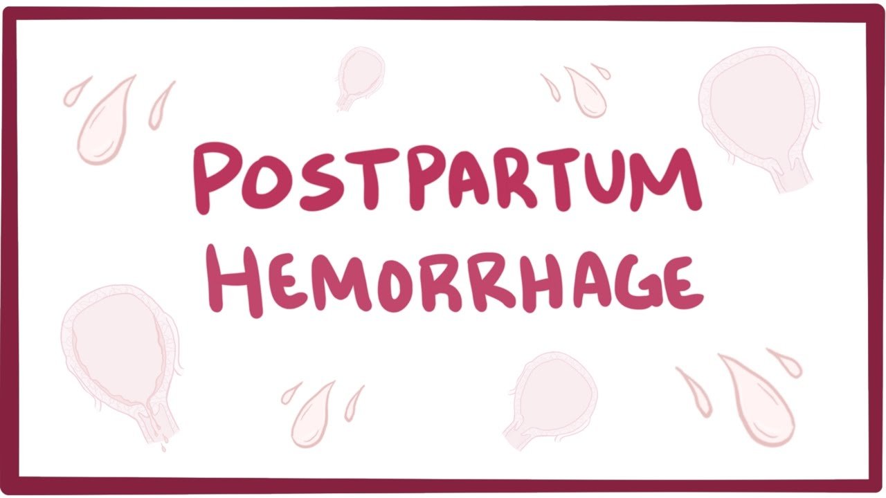 What is Postpartum Haemorrhage?