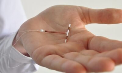 ParaGard IUD Removal Side Effects Lawsuit