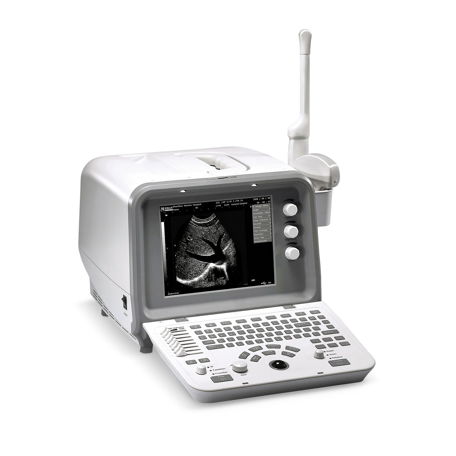 Fully Digital Ultrasound Machine Price in Lahore